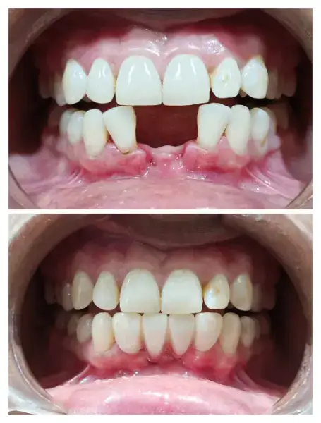 Samyak dental care and Implant Center Gallery Photo