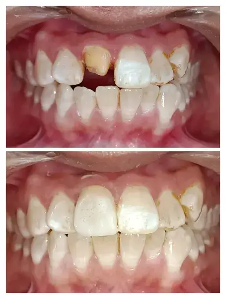 Samyak dental care and Implant Center Gallery Photo